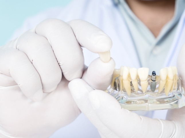 Dentist holding a dental crown in one hand and a dental implant model in the other