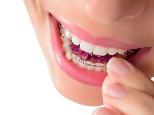 Close up of a person placing a retainer in their mouth