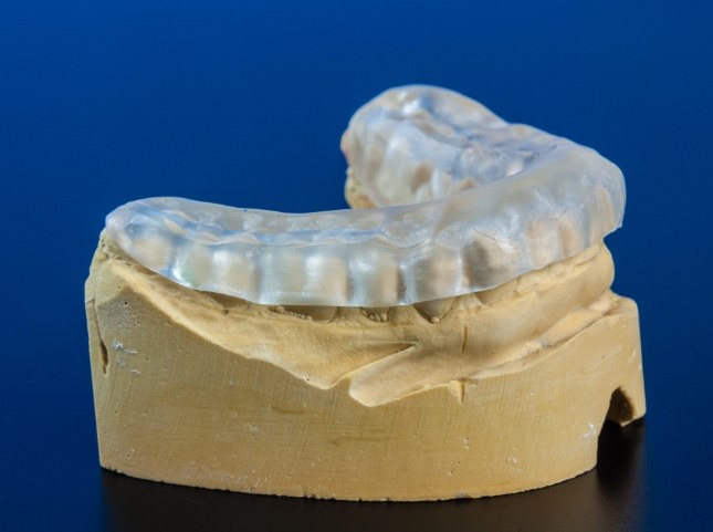 Model of the jaw with a clear nightguard over the teeth