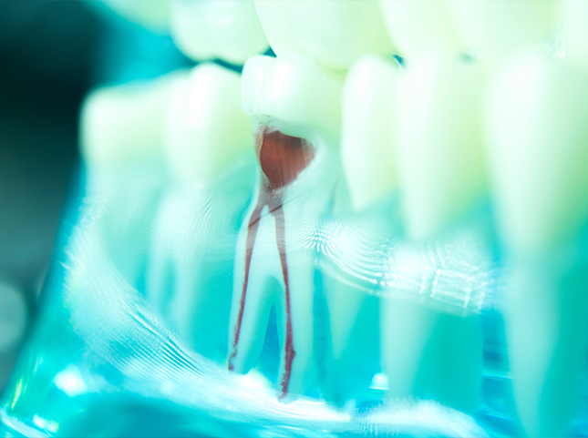 Model of tooth showing the root canals inside of it