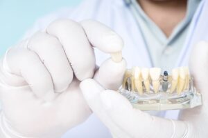 Dentist holding demonstration dental implant